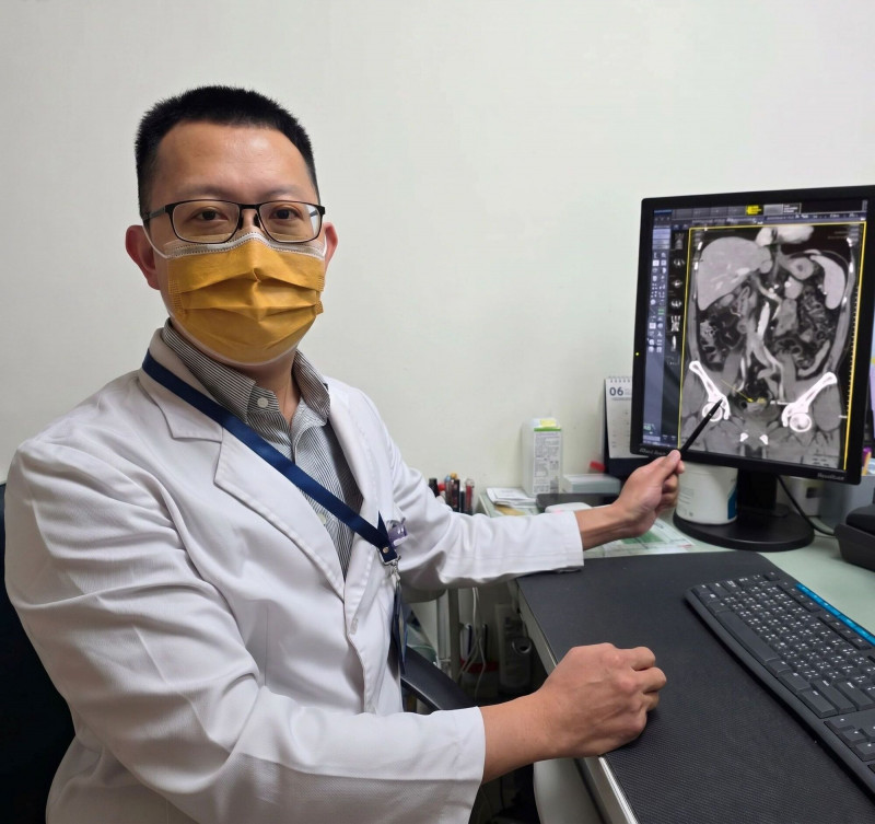 公費篩檢救命！苗栗51歲男無症狀 揪出罹患大腸癌第2期