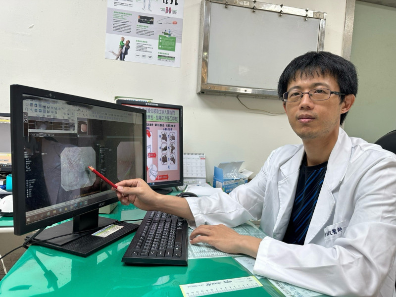 食道癌早期發現 內視鏡微創手術無傷口疼痛少