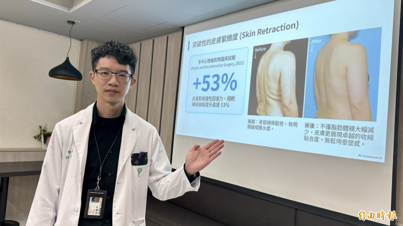 許翰平醫師強調,威塑抽脂並非單純減重手術,而是兼顧體態雕塑,自體脂肪應用存活率高。(記者劉婉君攝) 許翰平醫師強調,威塑抽脂並非單純減重手術,而是兼顧體態雕塑,自體脂肪應用存活率高。(記者劉婉君攝)