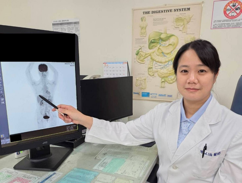 怕掉髮、疲憊？43歲乳癌女基因檢測評估低風險 成功免化療
