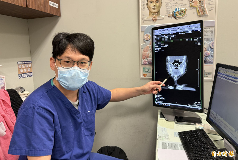 壯男下巴腫竟是唾液腺結石  醫師提醒「多喝水」
