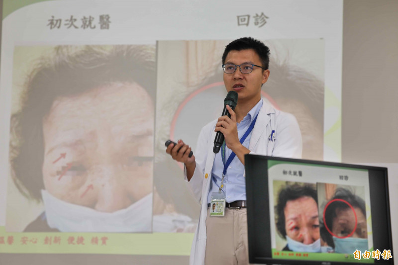 皮蛇爬上眼！8旬嬤右眼睜不開  險失明住院1週