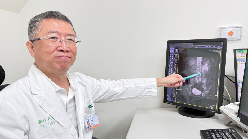 手搖飲當水喝  結石引發腎水腫 廚師「痛到腿軟」