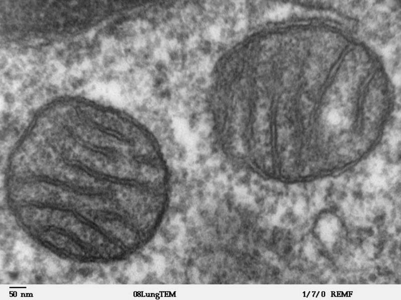 高倍率透射電子顯微鏡下的細胞粒線體(Mitochondria)結構。最新研究指出,關閉MTCH2蛋白會使粒線體分裂並降低能效,迫使細胞轉而消耗脂肪。(圖取自維基共享資源,屬公有領域) 高倍率透射電子顯微鏡下的細胞粒線體(Mitochondria)結構。最新研究指出,關閉MTCH2蛋白會使粒線體分裂並降低能效,迫使細胞轉而消耗脂肪。(圖取自維基共享資源,屬公有領域)
