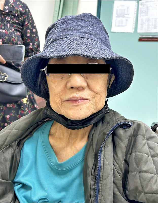 ▲ 洪姓婦人從今年初開始復健加中醫治療,至4月兩側臉型對稱,不再流口水。(台南市立醫院提供) ▲ 洪姓婦人從今年初開始復健加中醫治療,至4月兩側臉型對稱,不再流口水。(台南市立醫院提供)