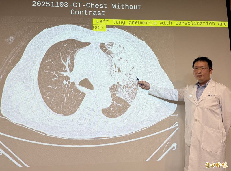 7旬翁重症肺炎多項檢驗找不到病原 快速PCR揪出退伍軍人菌
