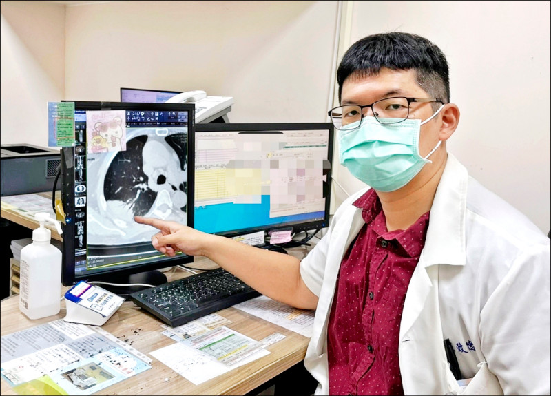 久咳以為感冒沒好 胸部X光揪出「會走路的肺炎」