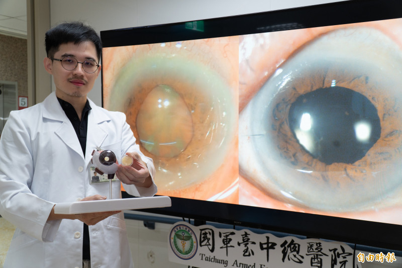 8旬翁視力只剩0.05 靠這健保白內障手術重見光明