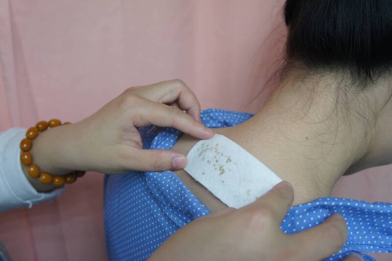 健康網》冬至後「三九貼」 中醫師：為來年調養身體