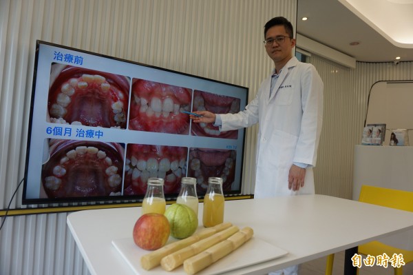 牙醫師陳易駿指出王姓國中生長期吃軟不吃硬，水果只喝果汁，導致齒顎空間不足，牙齒長歪、爆牙還長不出來。（記者蔡淑攝）