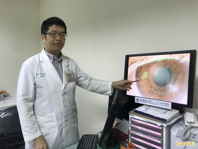 烏日林新醫院眼科主任薛維禎表示，游女在視力檢查時右眼度數只剩下0.5，角膜中央更出現像蛇行爬過的不規則破皮，一般無法用肉眼看出。
（記者蘇金鳳攝）