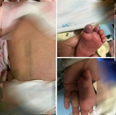 女嬰的阿嬤請友人上傳女嬰受虐照片。（照片取自臉書爆料公社）