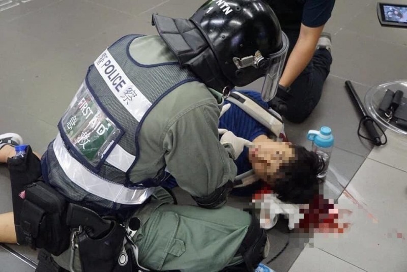 香港警方7日晚間進入港鐵大埔墟站追捕示威者時，以警棍毆打在場人士，導致1名17歲的朱姓學生頭破血流。（圖擷取自TG＿大埔總公海GP）