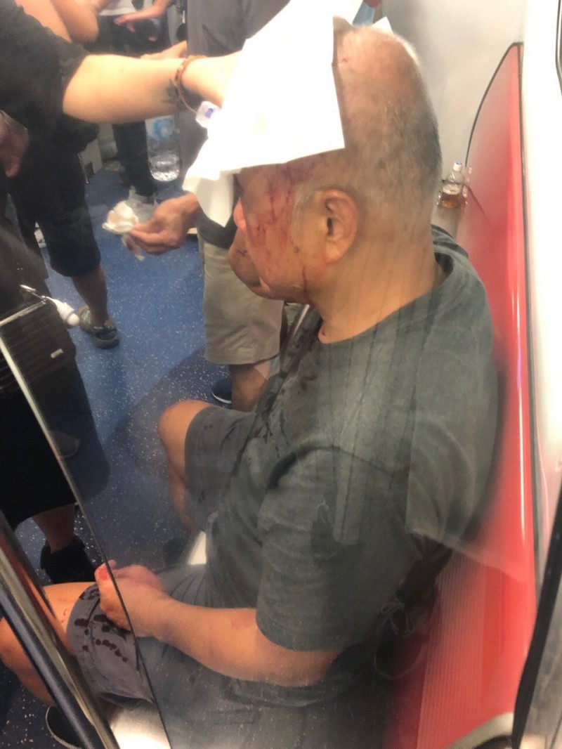 民眾在元朗站被打得頭破血流。（圖擷取自Telegram）