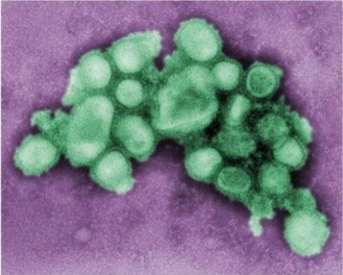 中國醫師推測，流感病毒恐已變種，能攻擊人類中樞神經。圖為H1N1病毒圖像。（法新社）