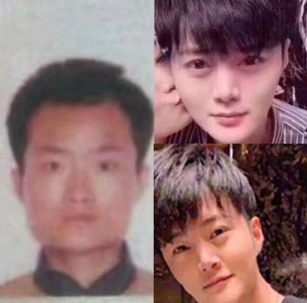 牛郎收富婆百萬禮被打斷腿整形前的真面目曝光了 國際 自由時報電子報