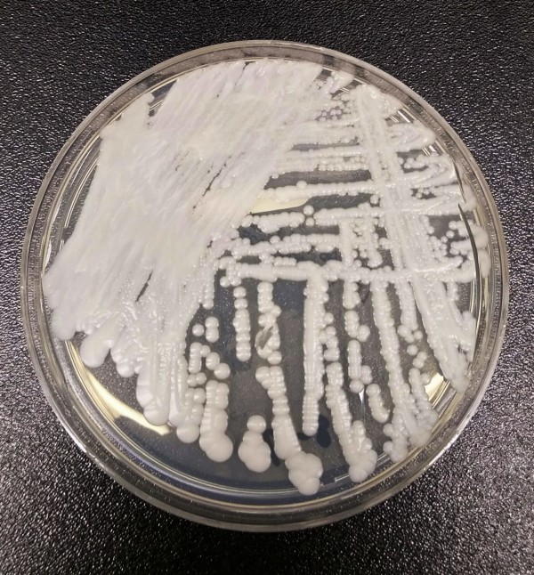 美國疾病防治中心（CDC）在實驗室中培養出的「耳念珠菌」。（美聯社）