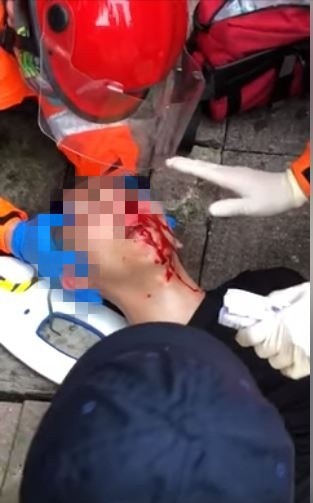 反送中 香港青年吐血急救影片流出 網 好心痛 國際 自由時報電子報