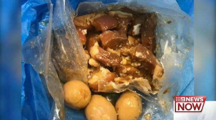 越南婦女因抵達雪梨時沒有申報其攜帶共10公斤的豬肉、海鮮和禽肉等，遭到遣返。（圖擷取自澳洲9NEWS影片）