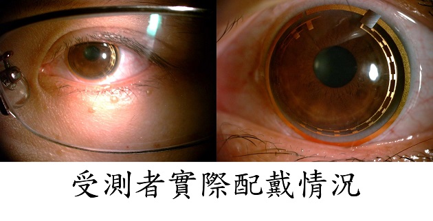 眼壓監測 戴隱形眼鏡就搞定