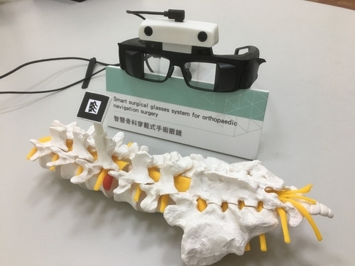 全球獨創智慧型醫療眼鏡，此醫材結合ＭＲ混合實境技術，同時計算眼鏡的位置與角度，將Ｘ光影像呈現在眼鏡上。