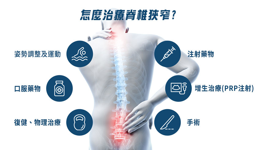 脊椎狹窄治療方式。(圖/菁英診所提供)