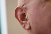 英男搭機後失聰近5年 從耳道「取出這物」聽力秒恢復