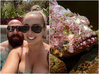 慘！新婚妻走沙灘遭「世界最毒魚」螫傷 腳腫一倍蜜月全泡湯