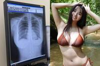 我的肺很乾淨！日本23歲H乳寫真女星秀X光照 網大歪樓看別處