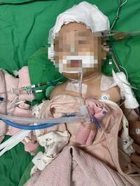 台中5月大女嬰腦傷開顱5次  保母測謊未過不起訴家屬不服