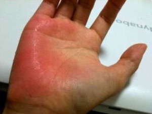 被騙用壽司店水龍頭洗手 燙傷網友：恨你們一輩子