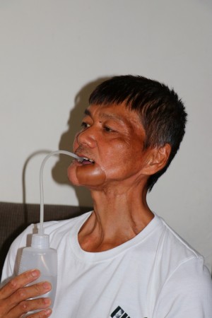 父親節願望 口腔癌爸爸:只盼重新工作養家 父親節願望 口腔癌爸爸:只盼重新工作養家