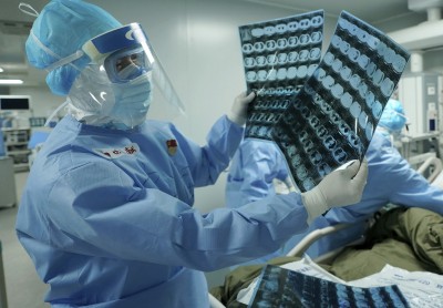 武漢肺炎》抗愛滋病藥物能抗疫？ 首份臨床實驗結果出爐