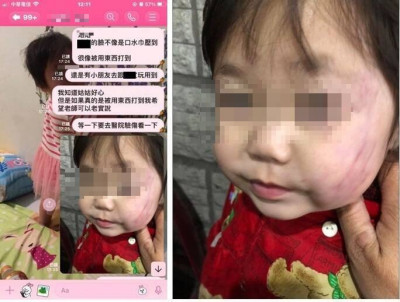 2歲女童臉大片瘀青！台南某補習班涉虐童 被處停止招生3個月