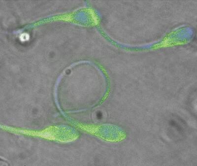 美國研究：空污影響精子DNA   降低男性生育力