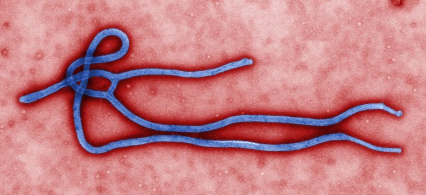圖為伊波拉病毒。（環保署）
