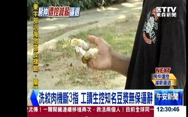 盧姓少年少指遭絞肉機捲入，導致三指骨折。（圖片擷取自東森新聞）