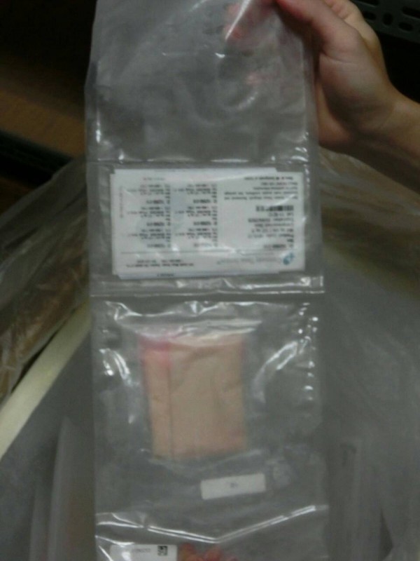 由美國進口台灣的大體皮膚。（圖由食藥署提供）