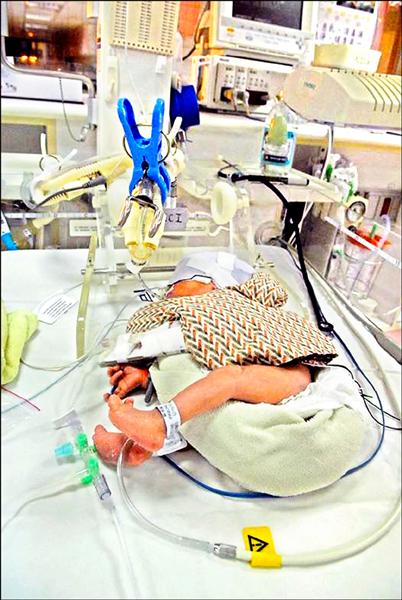 加護病房住太久病童不認得家人 即時新聞 自由健康網