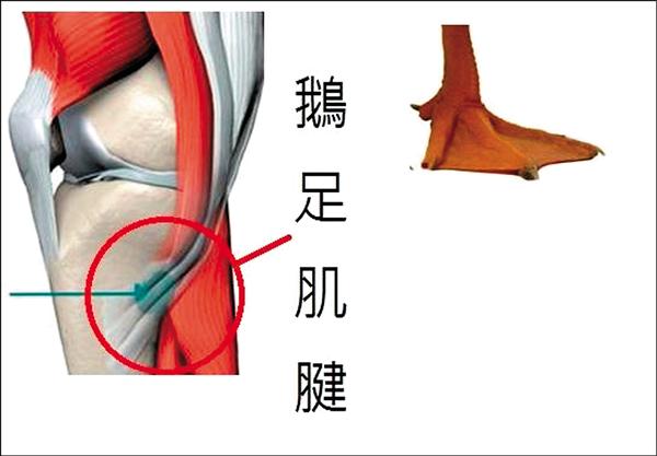 中年就膝蓋退化 原來是 鵝足肌腱炎 即時新聞 自由健康網