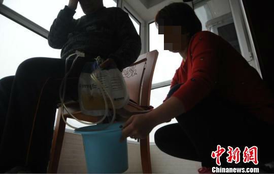只是治療右腿骨折,卻因醫師操作失誤,竟讓1名61歲的男子失去了命根子。(圖擷自中新網) 只是治療右腿骨折,卻因醫師操作失誤,竟讓1名61歲的男子失去了命根子。(圖擷自中新網)