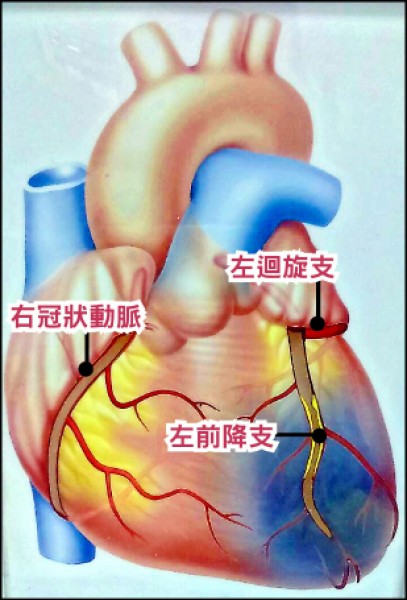 進香客心臟罷工15分鐘手術7小時救回 即時新聞 自由健康網