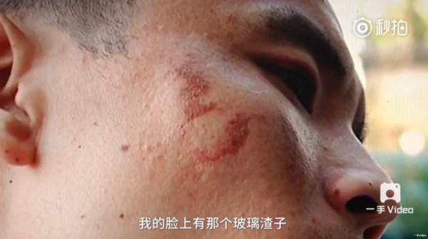 男子臉上遭玻璃渣刺傷。（翻攝影片）