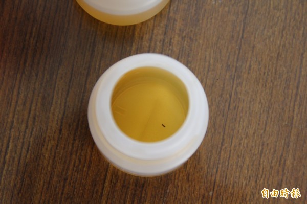 尿液像烏龍茶檢查才知膽管結石 即時新聞 自由健康網