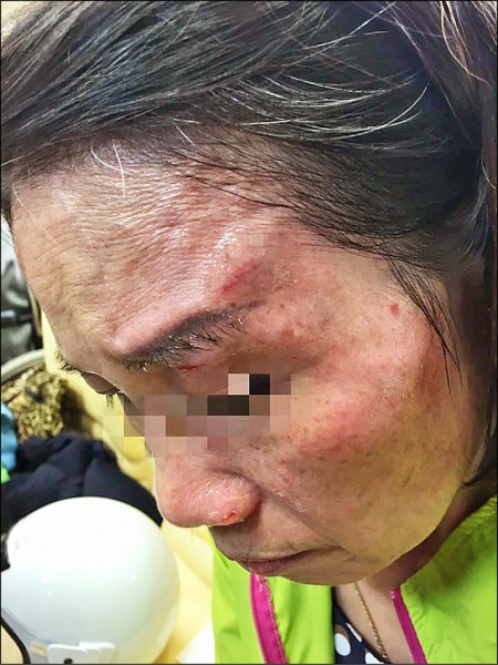 台北市寧夏夜市26日晚間發生空拍機砸傷人意外，市議員顏若芳證實傷者就是自己母親，頭部受到撞擊，太陽穴上方、鼻翼及眼皮都被割傷，手臂也被螺旋槳割破。（取自顏若芳臉書）