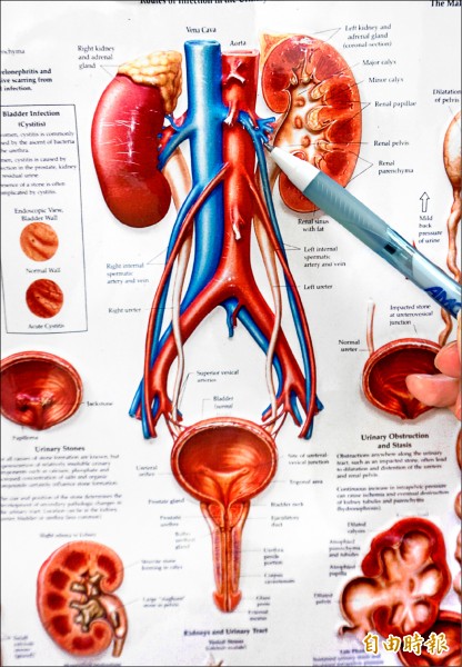 陰囊痛 有如滿袋蚯蚓精索靜脈曲張作怪 即時新聞 自由健康網