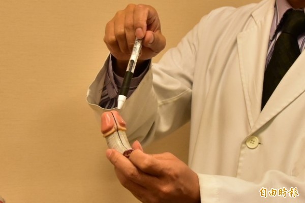 慘 男大生diy太激烈繫帶斷裂天天被痛醒 即時新聞 自由健康網