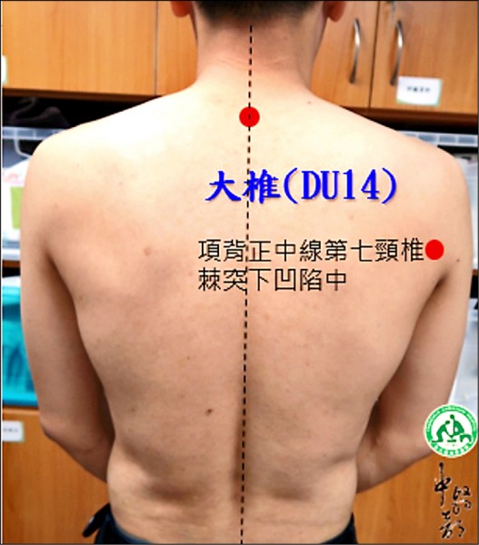 熱天常中暑中醫緩解有一套 即時新聞 自由健康網