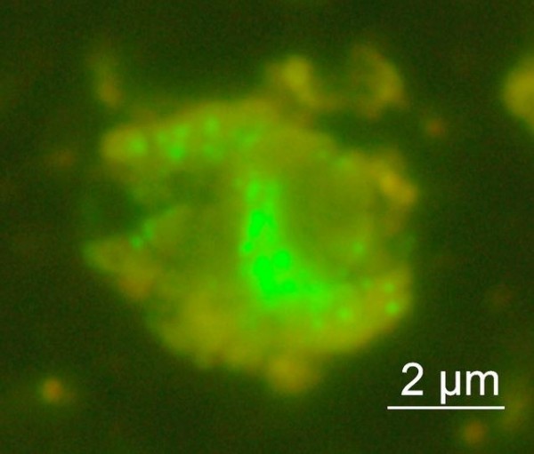 科學家發現的新細菌，可耐強鹼、不需氧氣，生存機制目前不明。（圖擷取自朝日新聞）