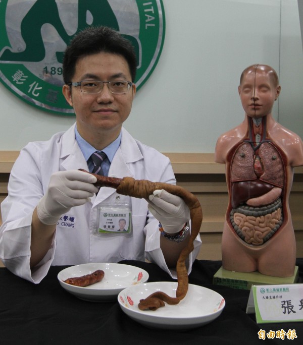 罕見 大腸包小腸男大生腸套疊鬧肚疼 即時新聞 自由健康網